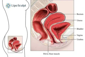 Treatment For A Leaky Bladder 2 How EM Chair treatment Cheshunt can help Leaky bladder issues. Read more now!