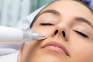 Best Actinic Keratoses Removal 3 Actinic keratoses Cheshunt solutions - book in today!